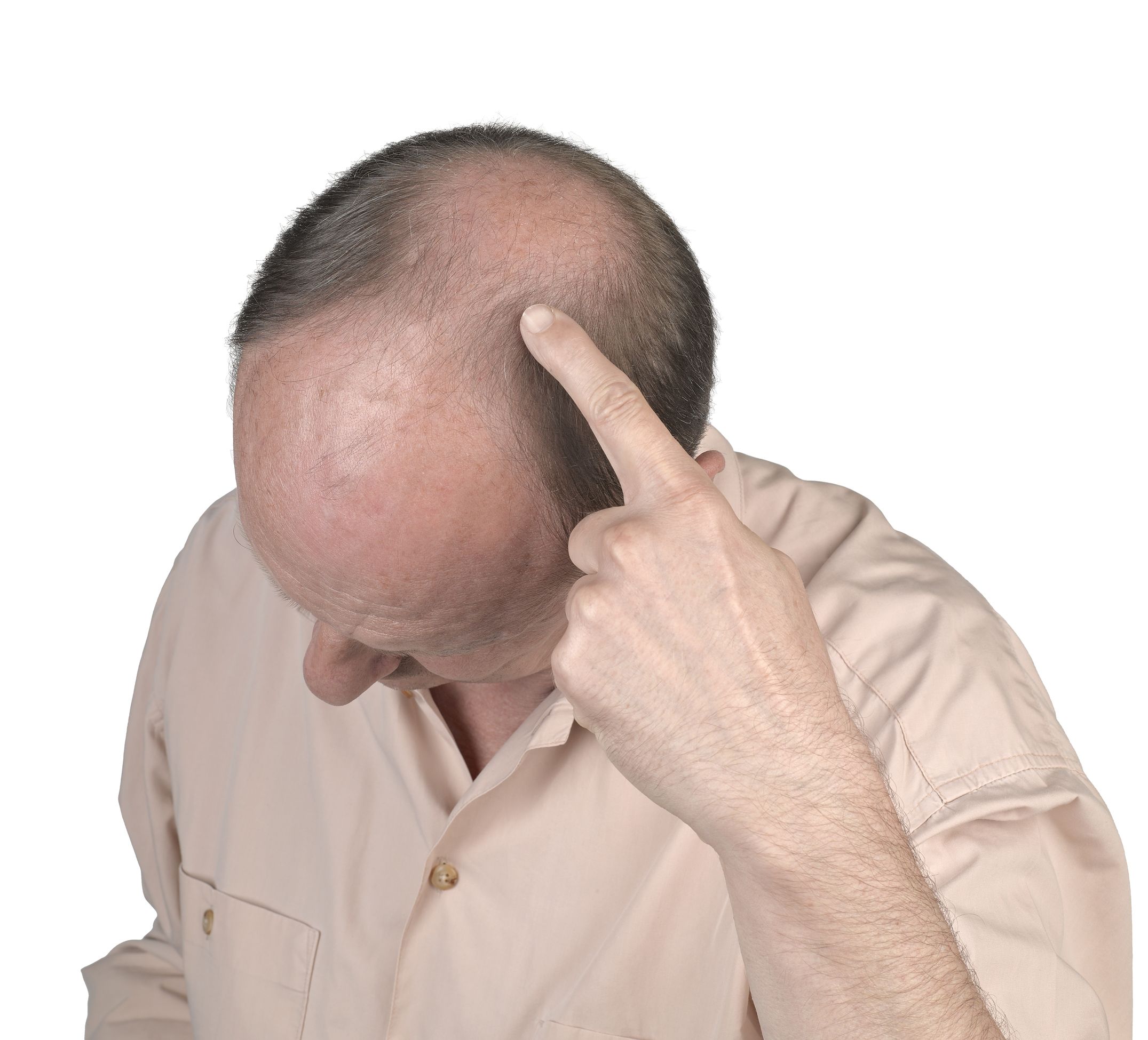 Is Hair Growth Treatment Omaha NE the Answer to Your Hair Loss Concerns