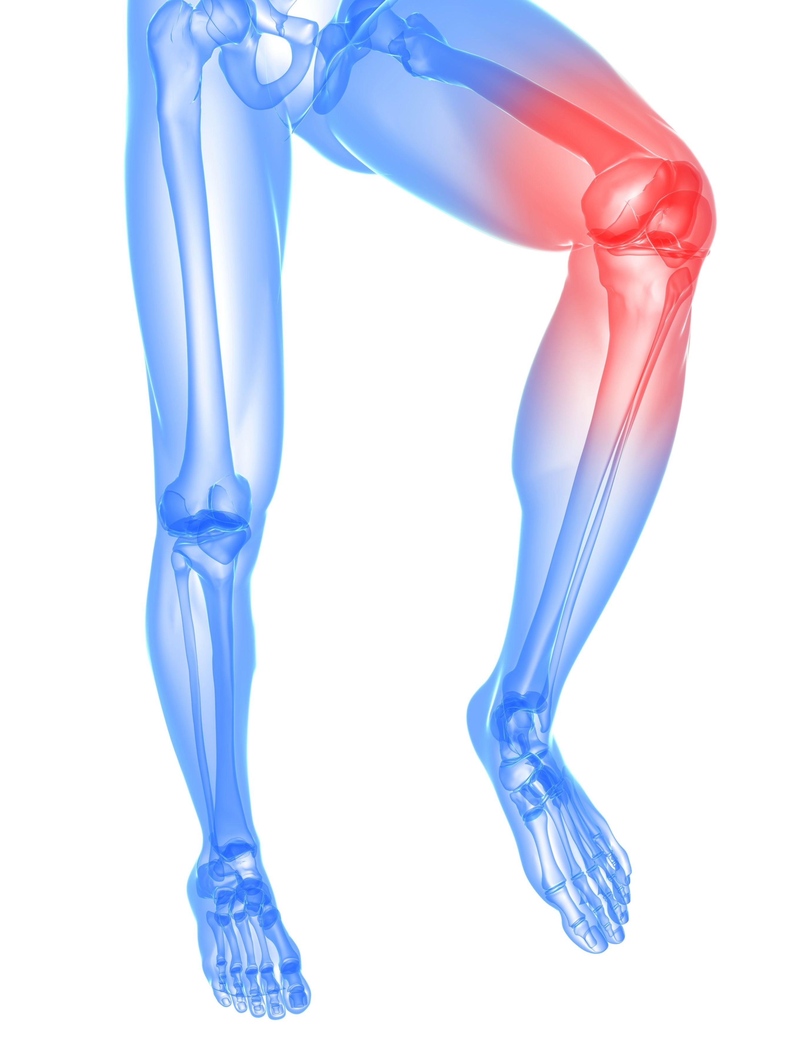 Quick Guide To Joint Replacement In Boca Raton FL