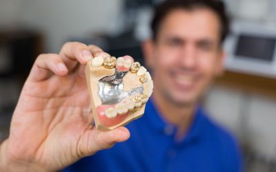 Tips For Maximizing Returns When Selling Dental Gold