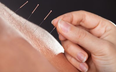 Acupuncture Clinic in Burbank, CA: Discover Natural Healing for Pain Relief, Stress Reduction, and Overall Wellness