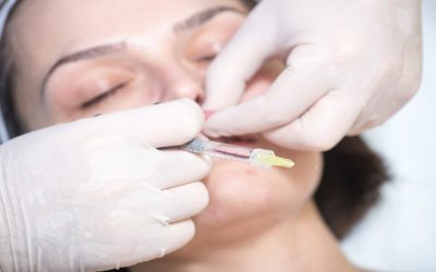 Reveal Youthful Radiance by Choosing a Chemical Peel In Fayetteville Solution