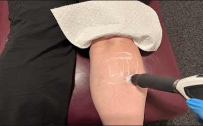 Shockwave Therapy for Knee Pain: A Non-Invasive Alternative to Surgery