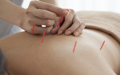 Unlock Pain Relief Benefits With a Registered Acupuncturist in Toronto, ON for Better Wellness