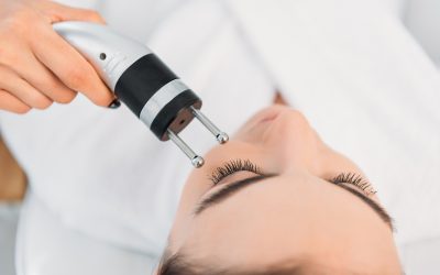 Microneedling in Marietta, GA for Smoother, Youthful-Looking Skin