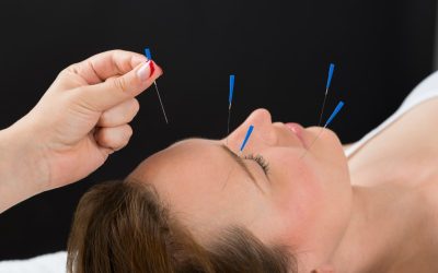 Find Natural Balance Through Acupuncture For Stress: Union City, CA Wellness Centers Provide